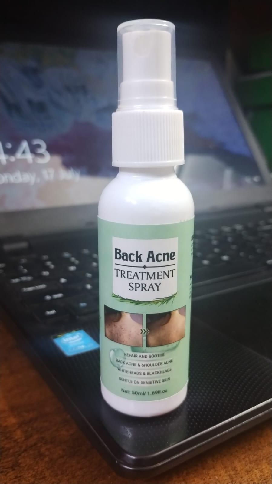 Back Acne Treatment Spray (Pack of 1)