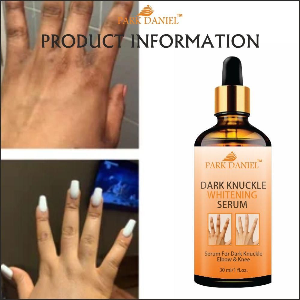 Park Daniel Skin Whitening Serum For Removaing Dark Knuckles From Hand, Elbows and Knees Pack of 4 of 30 ML(120 ML)